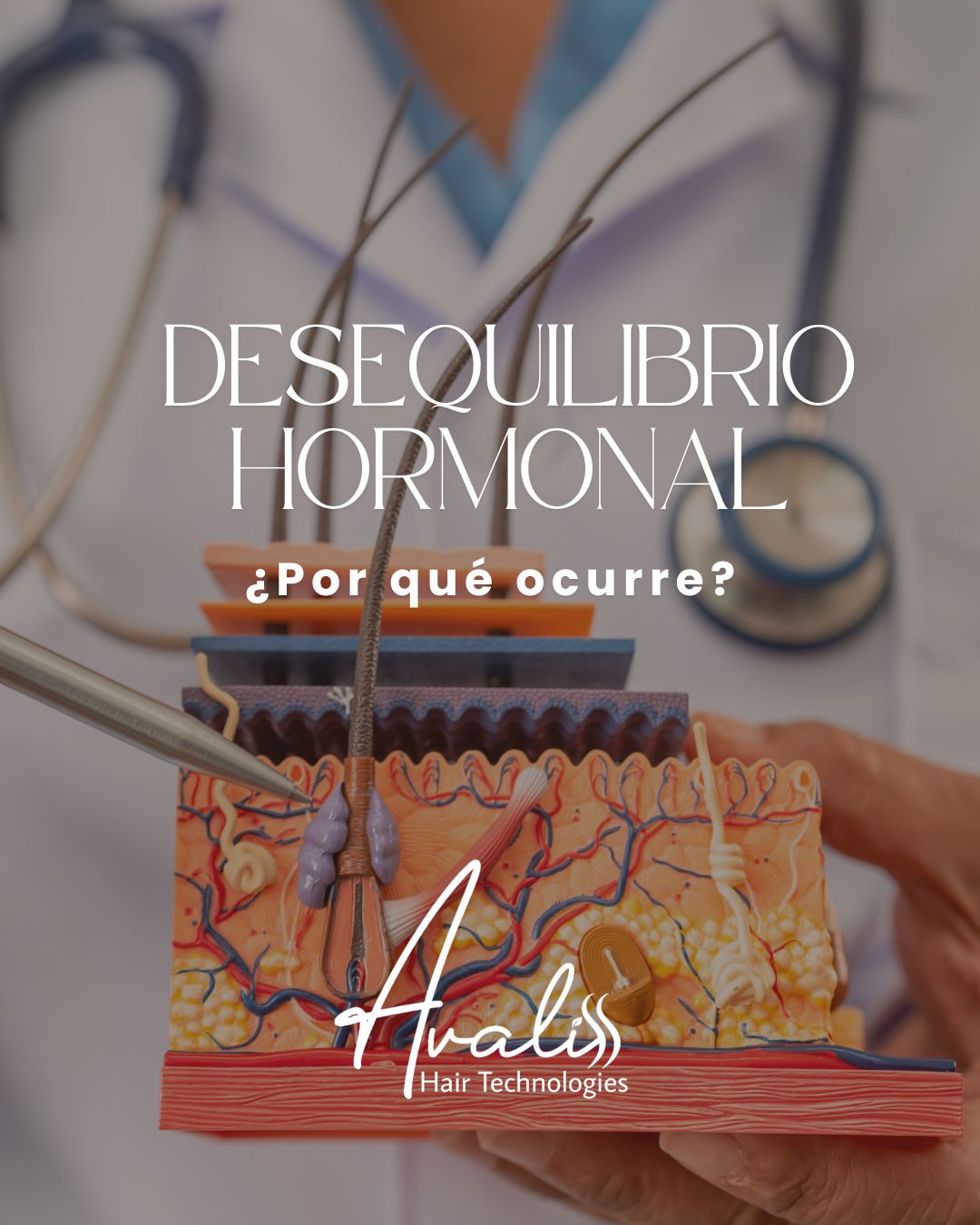 DESEQUILIBRIO HORMONAL