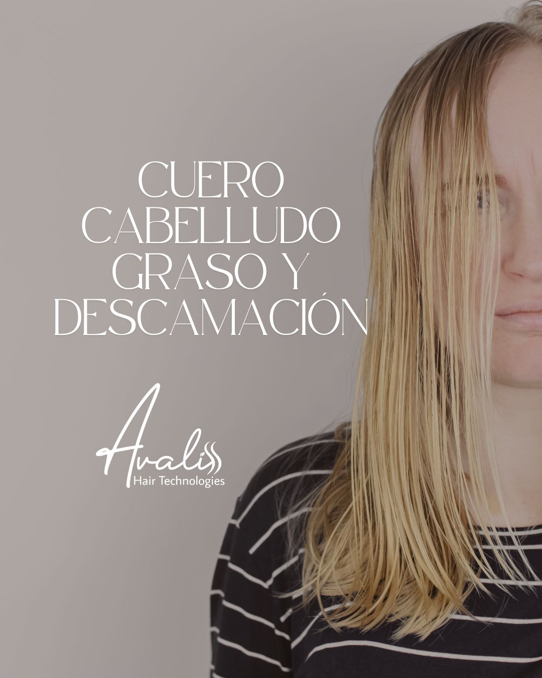 Desequilibrio del cuero cabelludo